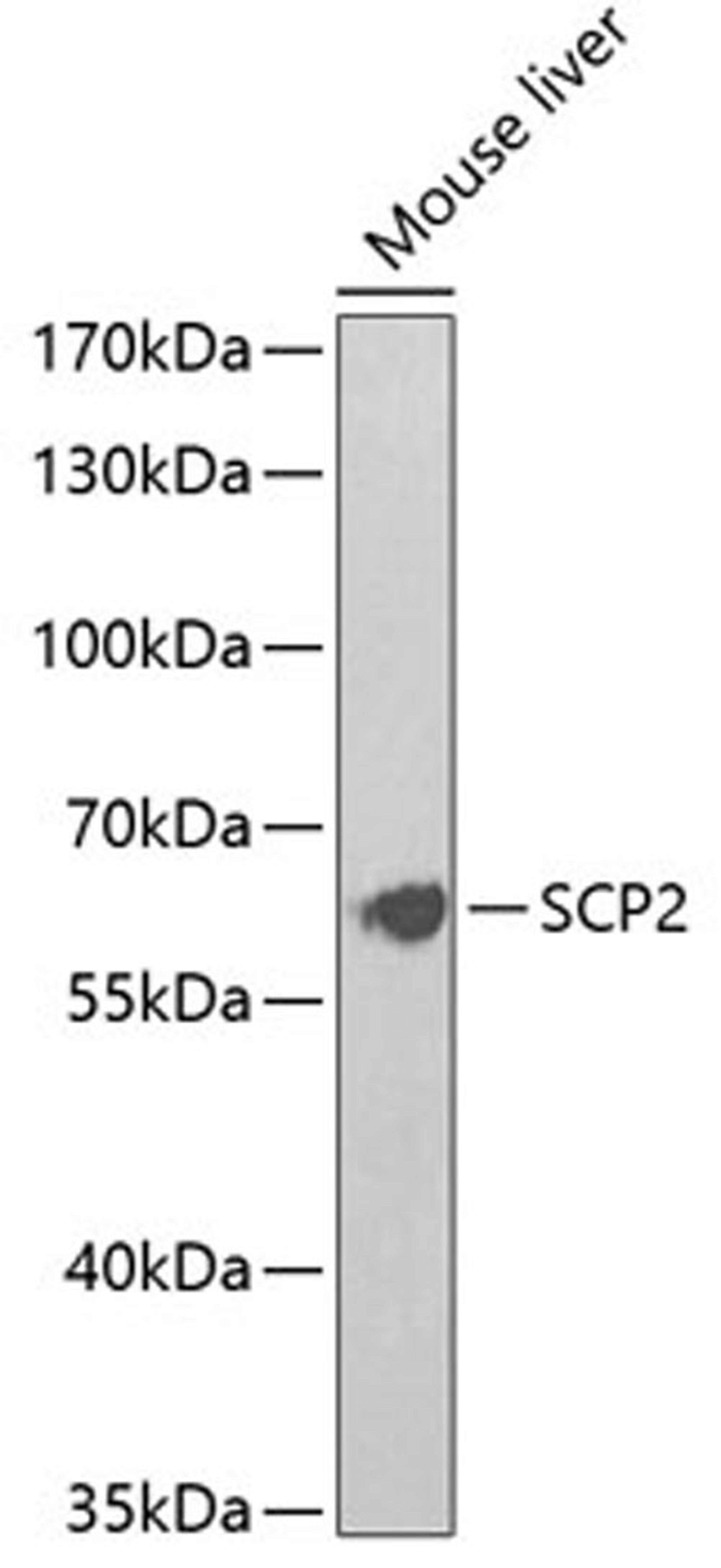 Western blot - SCP2 Antibody (A5382)