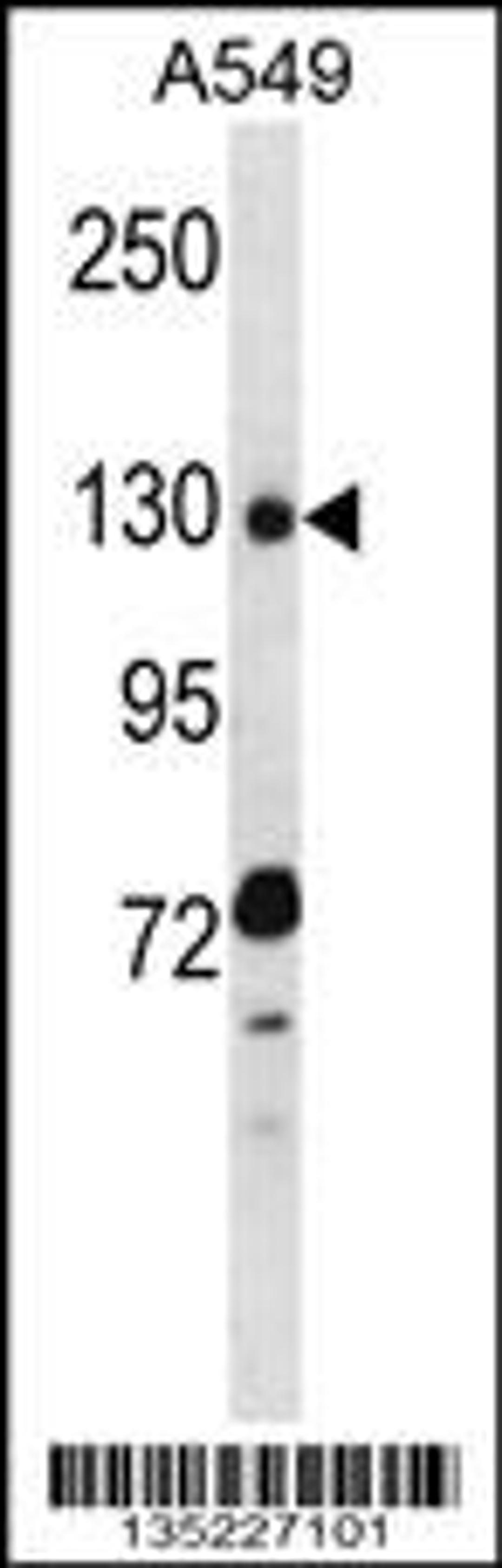 Western blot analysis in A549 cell line lysates (35ug/lane).