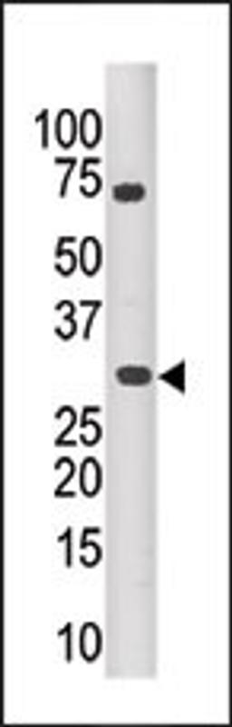 Antibody is used in Western blot to detect PIM3 in mouse kidney tissue lysate.