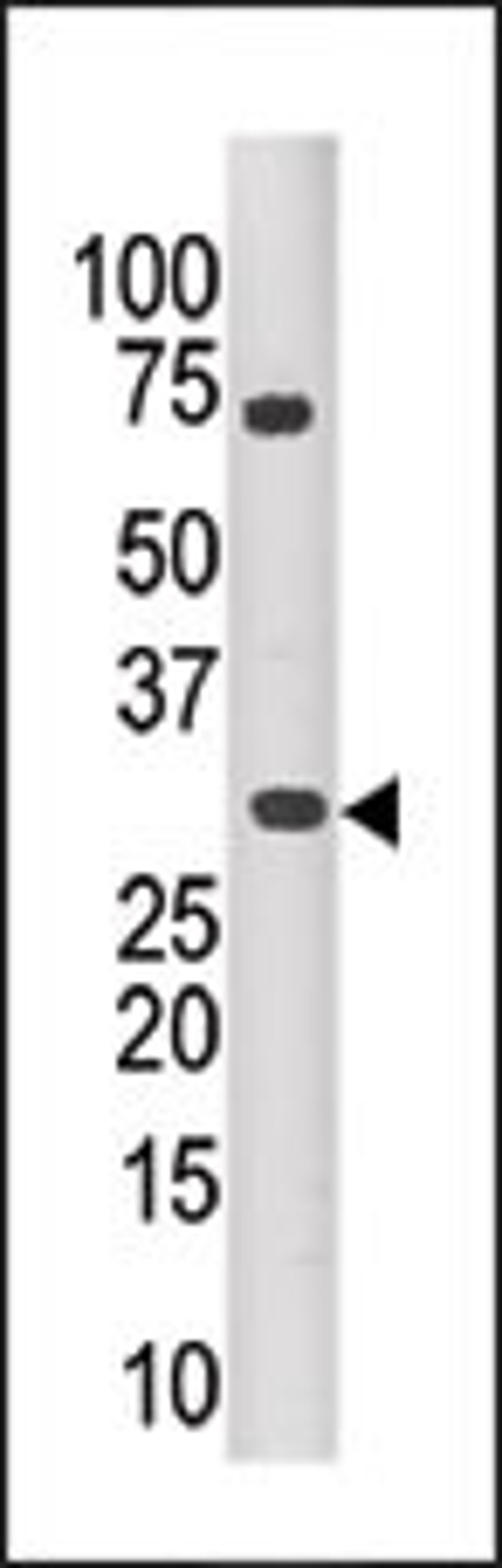 Antibody is used in Western blot to detect PIM3 in mouse kidney tissue lysate.