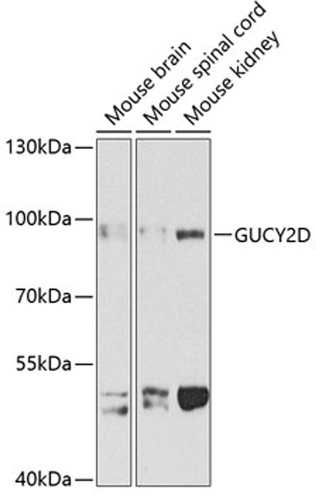 Western blot - GUCY2D antibody (A3605)