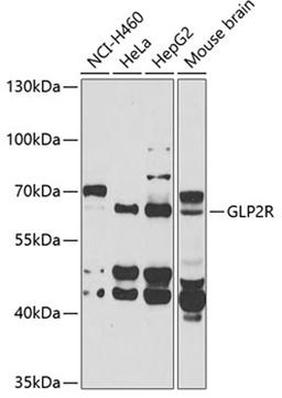 Western blot - GLP2R antibody (A6602)