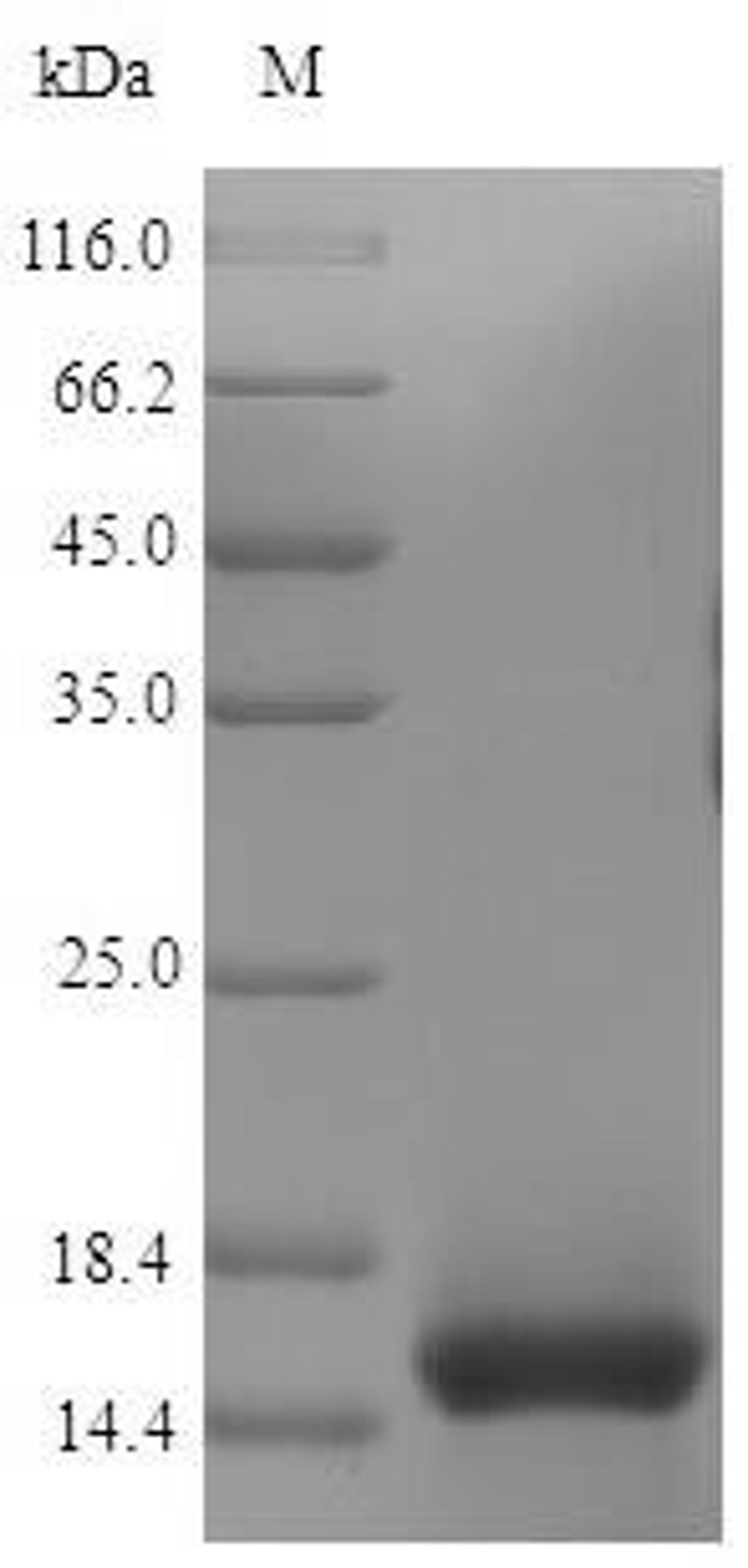 (Tris-Glycine gel) Discontinuous SDS-PAGE (reduced) with 5% enrichment gel and 15% separation gel.