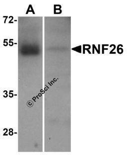 Western blot analysis of RNF26 in (A) human tonsil and (B) rat stomach tissue lysate with RNF26 antibody at 1 μg/mL.