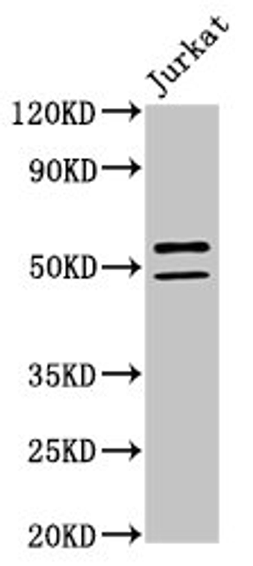 Western Blot. Positive WB detected in: Jurkat whole cell lysate. All lanes: NOVA1 antibody at 2µg/ml. Secondary. Goat polyclonal to rabbit IgG at 1/50000 dilution. Predicted band size: 53, 20, 50, 52 kDa. Observed band size: 53, 50 kDa