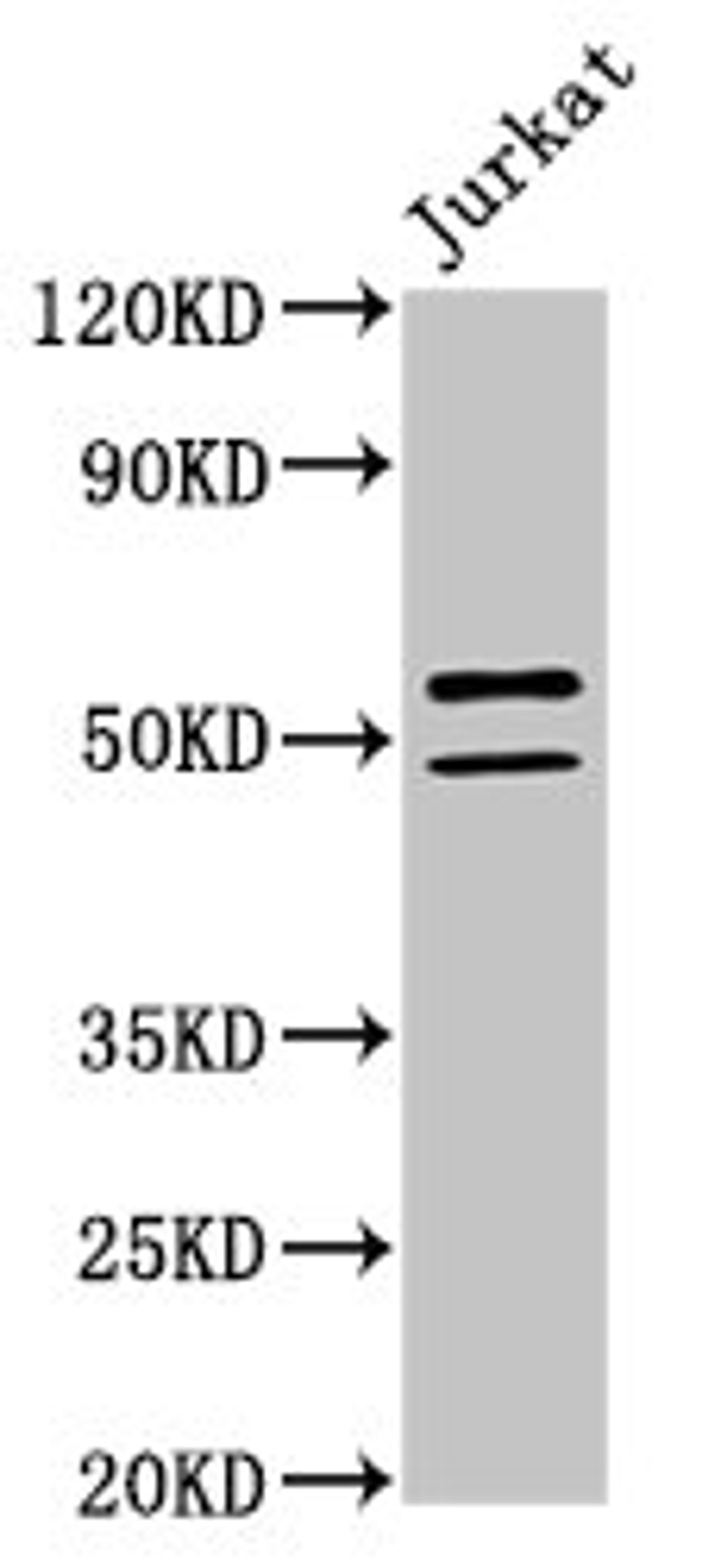 Western Blot. Positive WB detected in: Jurkat whole cell lysate. All lanes: NOVA1 antibody at 2µg/ml. Secondary. Goat polyclonal to rabbit IgG at 1/50000 dilution. Predicted band size: 53, 20, 50, 52 kDa. Observed band size: 53, 50 kDa