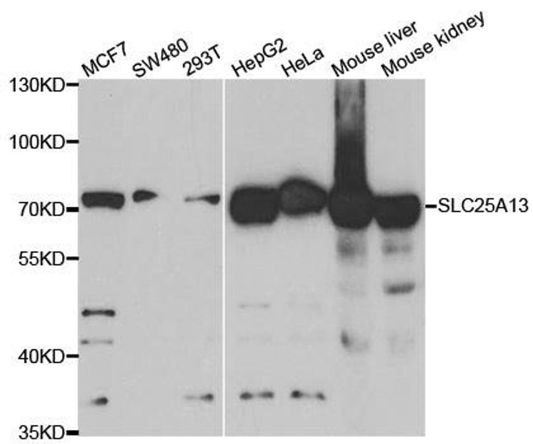 Western blot analysis of extracts of various cell lines using SLC25A13 antibody