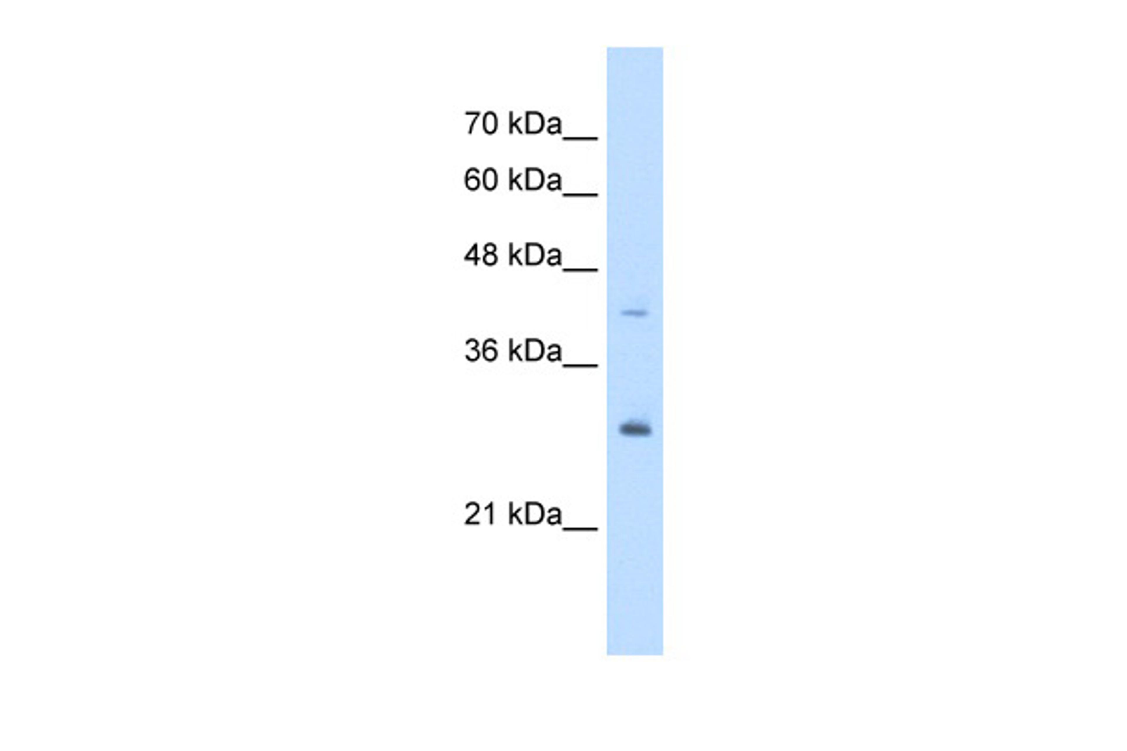 Antibody used in WB on Human HepG2 at 5.0 ug/ml.