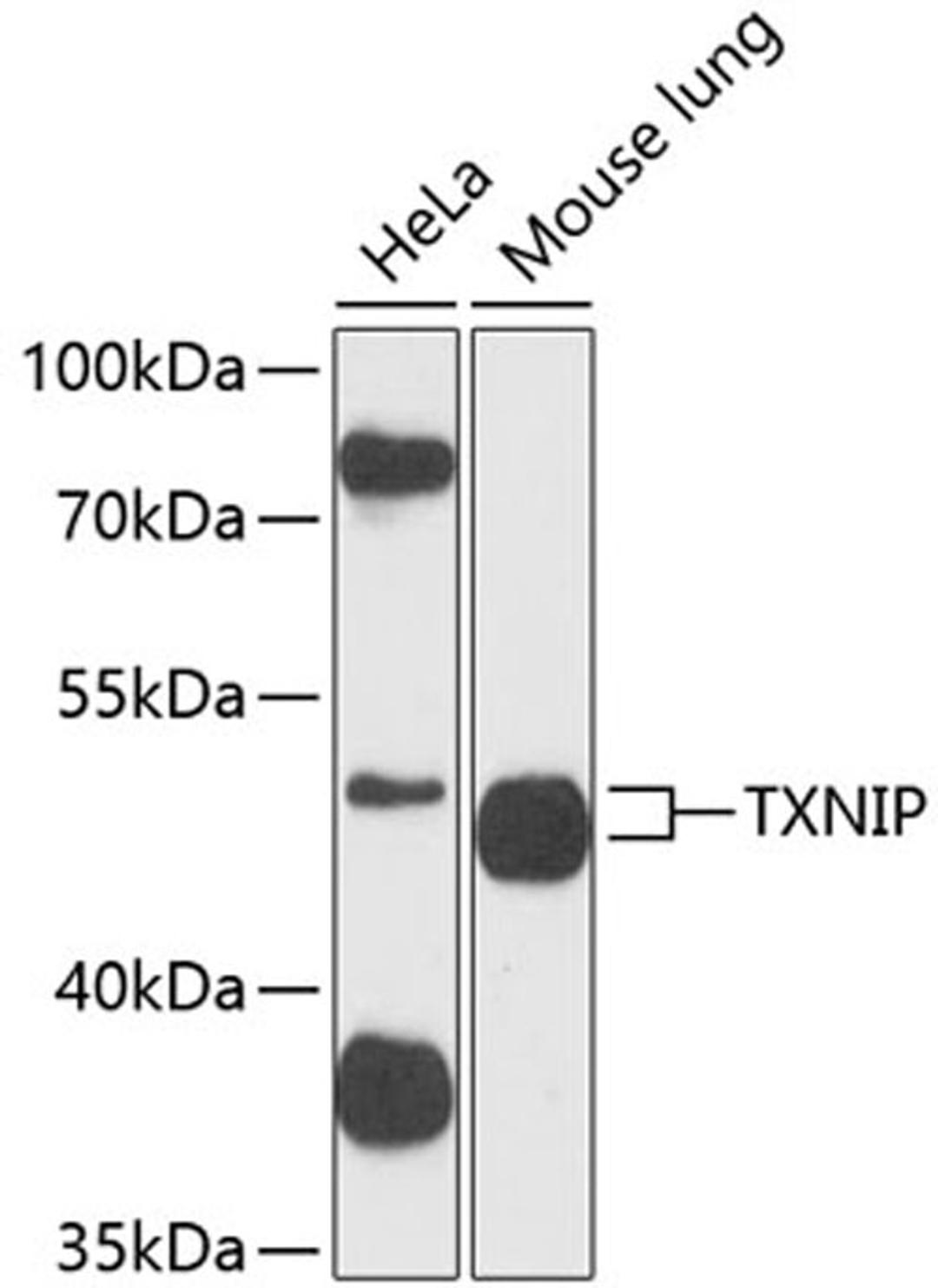 Western blot - TXNIP antibody (A9342)