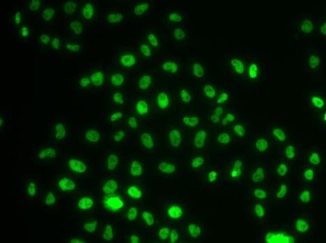 Immunofluorescense analysis of MCF7 cell using PHIP antibody