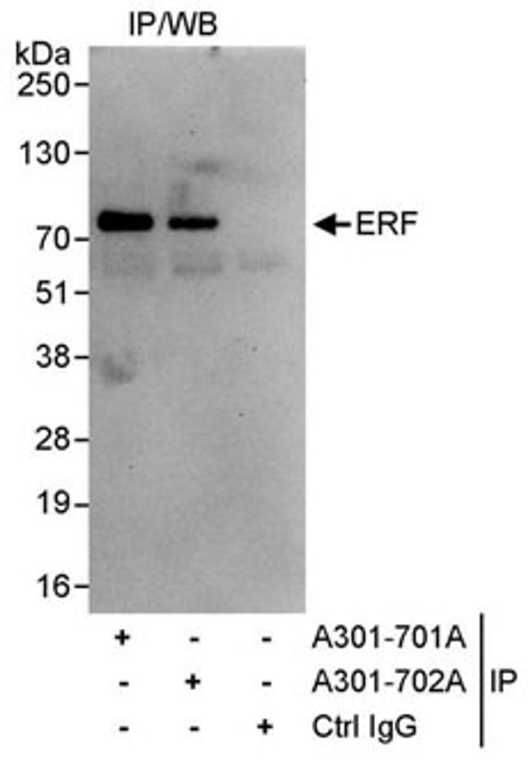 Detection of human ERF by western blot of immunoprecipitates.