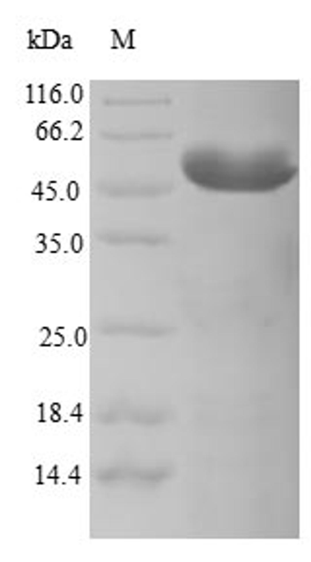 (Tris-Glycine gel) Discontinuous SDS-PAGE (reduced) with 5% enrichment gel and 15% separation gel.