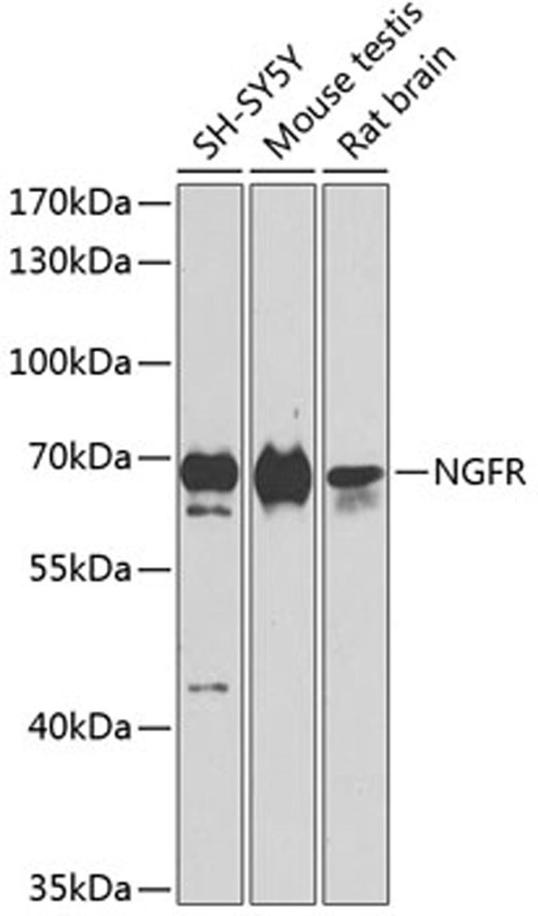 Western blot - NGFR antibody (A11169)