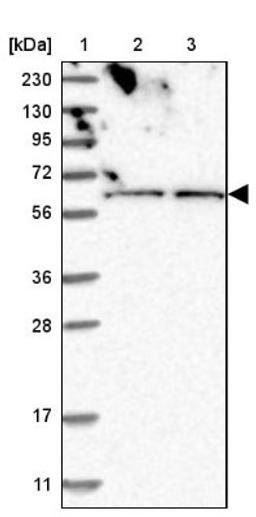 Western Blot: ZNF48 Antibody [NBP1-84088] - Lane 1: Marker [kDa] 230, 130, 95, 72, 56, 36, 28, 17, 11<br/>Lane 2: Human cell line RT-4<br/>Lane 3: Human cell line U-251MG sp