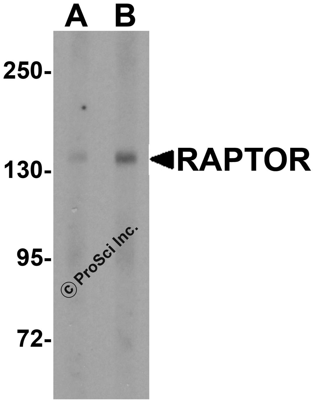 Western blot analysis of Raptor in L1210 cell lysate with Raptor antibody at (A) 2 and (B) 4 μg/mL.