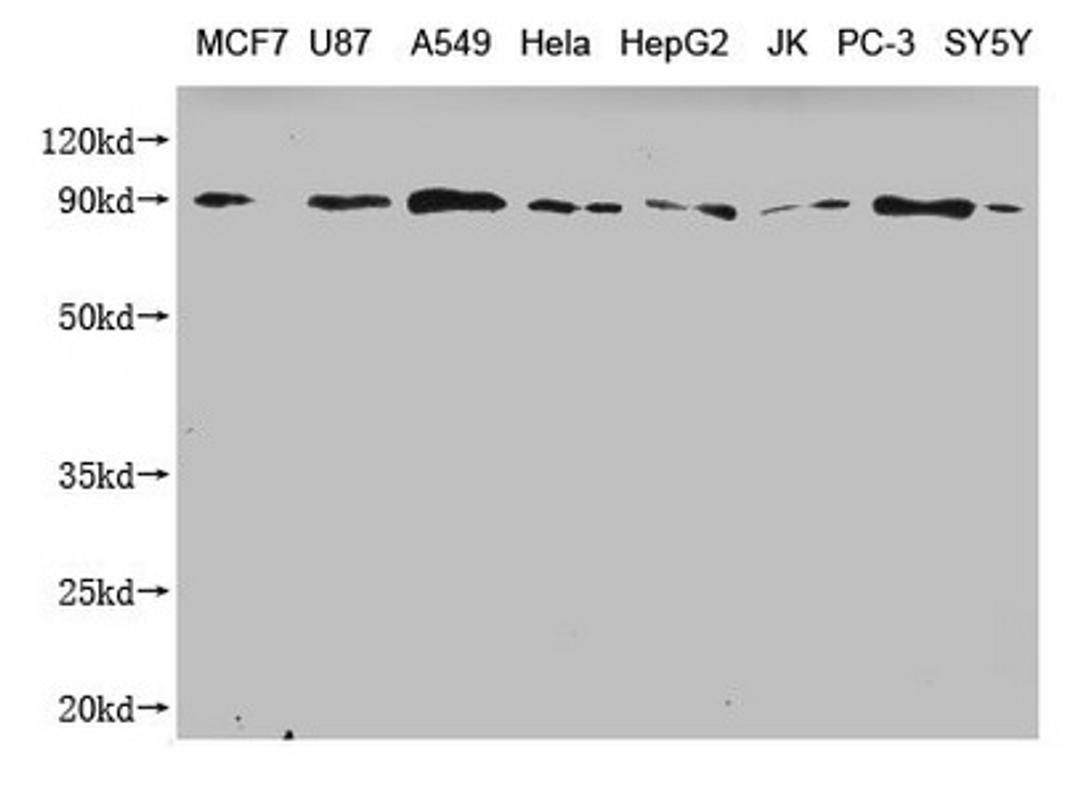 Western Blot. Positive WB detected in: MCF7 whole cell lysate, U87 whole cell lysate, A549 whole cell lysate, Hela whole cell lysate, HepG2 whole cell lysate, JK whole cell lysate, PC-3 whole cell lysate, SY5Y whole cell lysate . All lanes: CANX antibody at 1:2000. Secondary. Goat polyclonal to mouse IgG at 1/50000 dilution. Predicted band size: 68, 72, 56 kDa. Observed band size: 90 KDa. Exposure time:5min