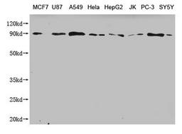 Western Blot. Positive WB detected in: MCF7 whole cell lysate, U87 whole cell lysate, A549 whole cell lysate, Hela whole cell lysate, HepG2 whole cell lysate, JK whole cell lysate, PC-3 whole cell lysate, SY5Y whole cell lysate . All lanes: CANX antibody at 1:2000. Secondary. Goat polyclonal to mouse IgG at 1/50000 dilution. Predicted band size: 68, 72, 56 kDa. Observed band size: 90 KDa. Exposure time:5min