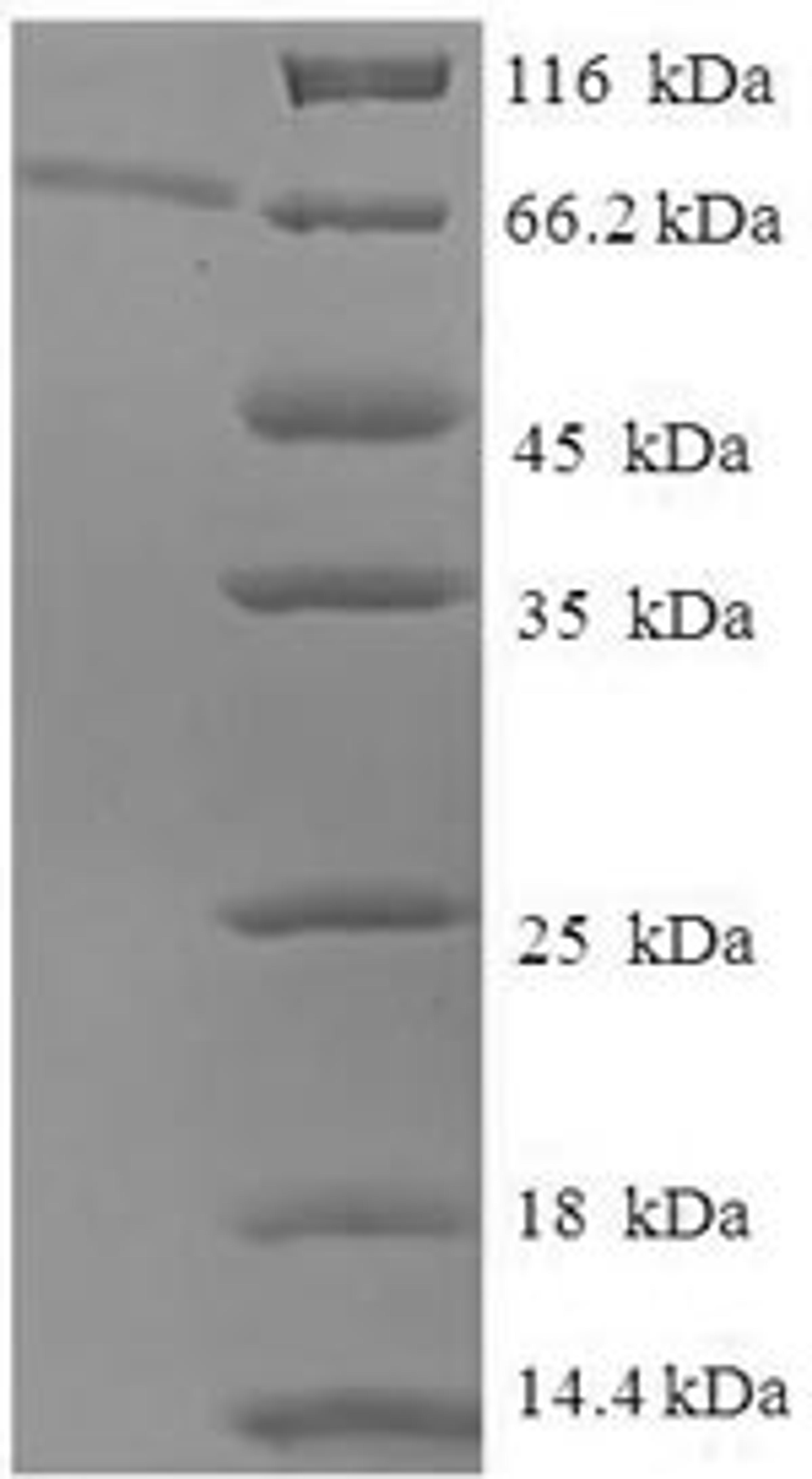 (Tris-Glycine gel) Discontinuous SDS-PAGE (reduced) with 5% enrichment gel and 15% separation gel.