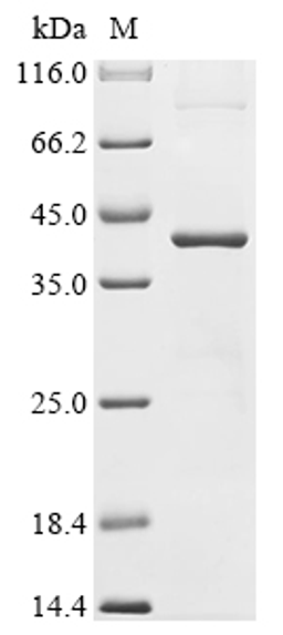 (Tris-Glycine gel) Discontinuous SDS-PAGE (reduced) with 5% enrichment gel and 15% separation gel.