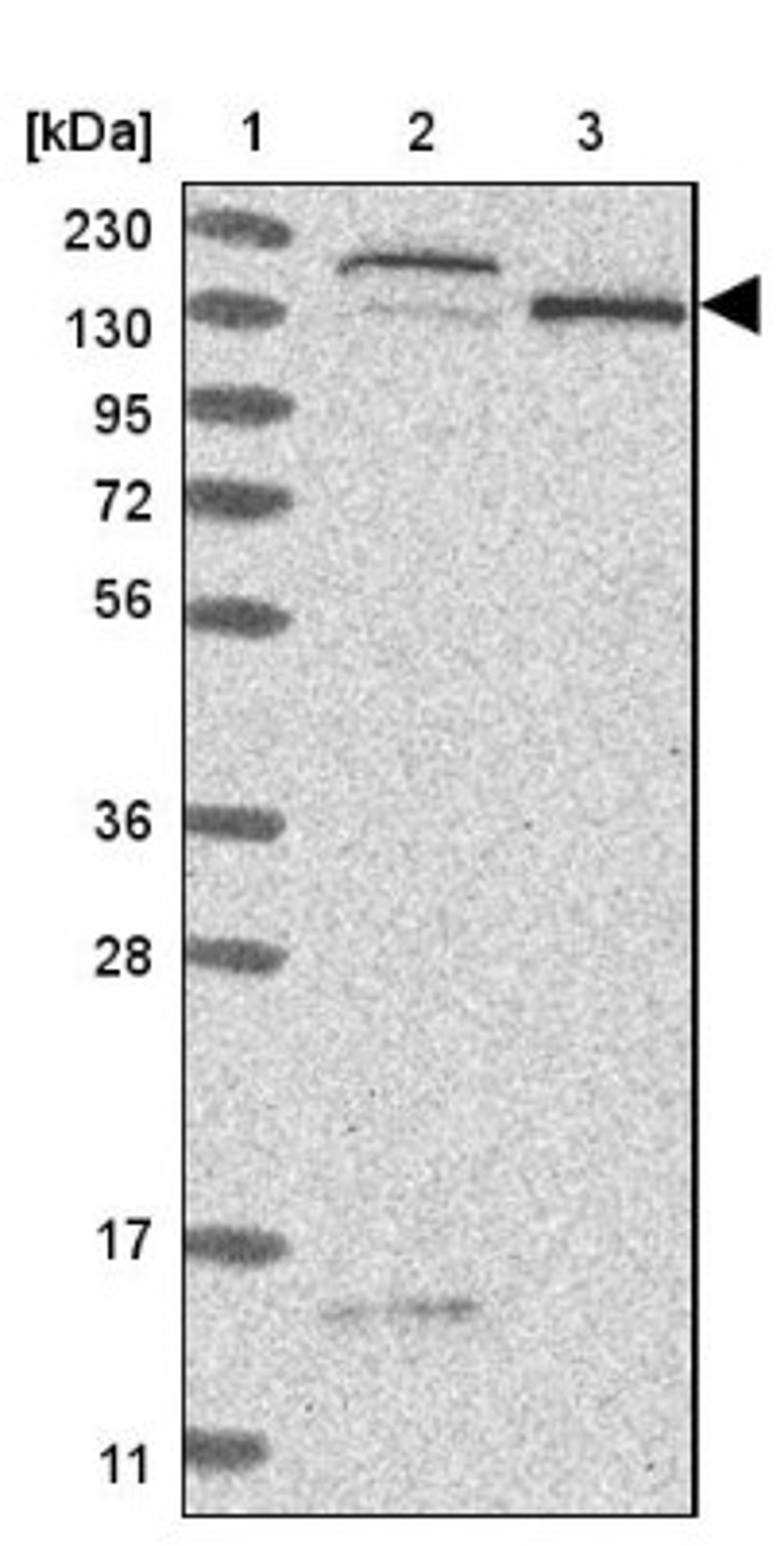 Western Blot: NCAPG2 Antibody [NBP1-86633] - Lane 1: Marker [kDa] 230, 130, 95, 72, 56, 36, 28, 17, 11<br/>Lane 2: Human cell line RT-4<br/>Lane 3: Human cell line U-251MG sp