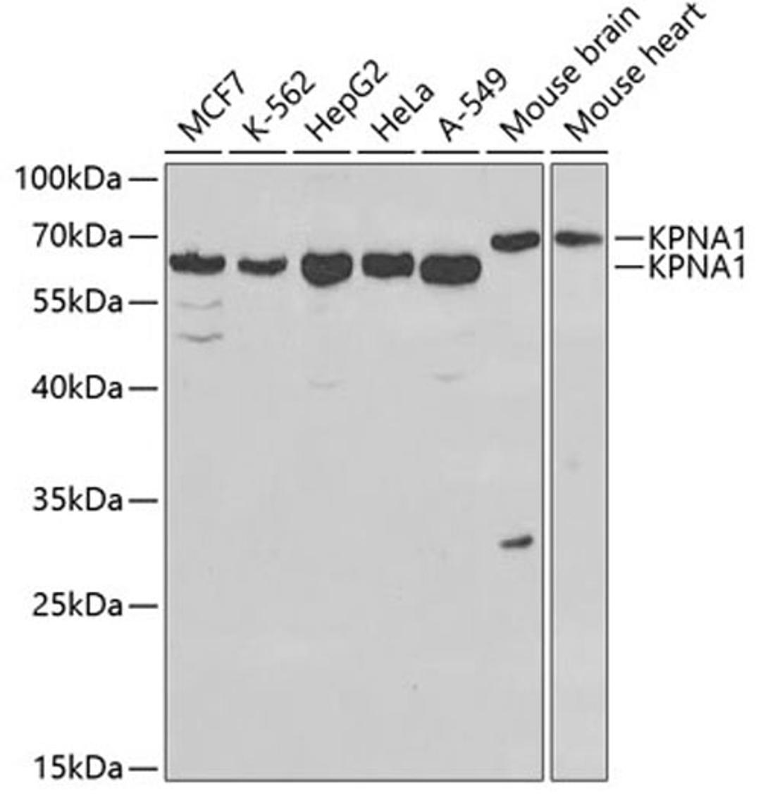 Western blot - KPNA1 antibody (A1742)