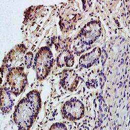 Immunohistochemical analysis of formalin-fixed and paraffin embedded rat colitis tissue (Dilution at:1:200) using CD98 antibody