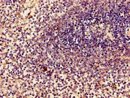Immunohistochemistry of paraffin-embedded human spleen tissue using CSB-PA10059A0Rb at dilution of 1:100