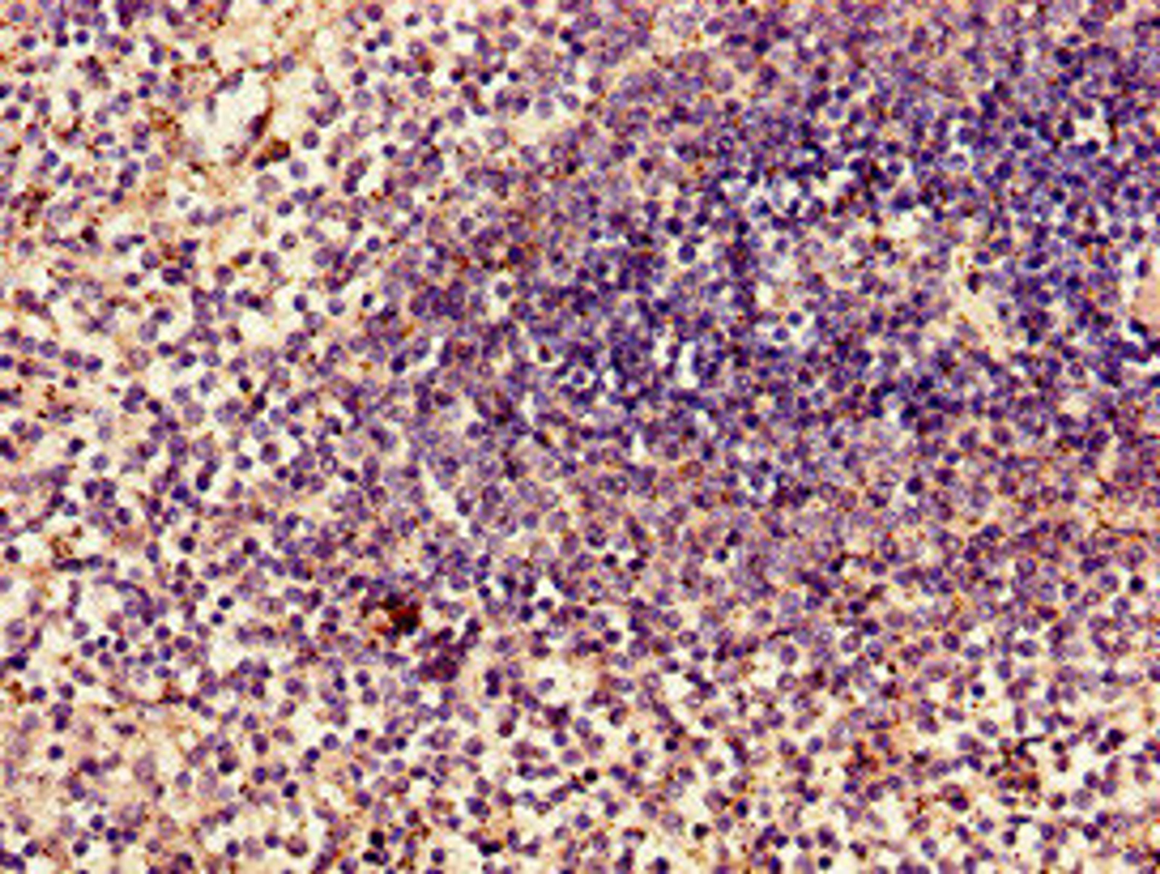 Immunohistochemistry of paraffin-embedded human spleen tissue using CSB-PA10059A0Rb at dilution of 1:100