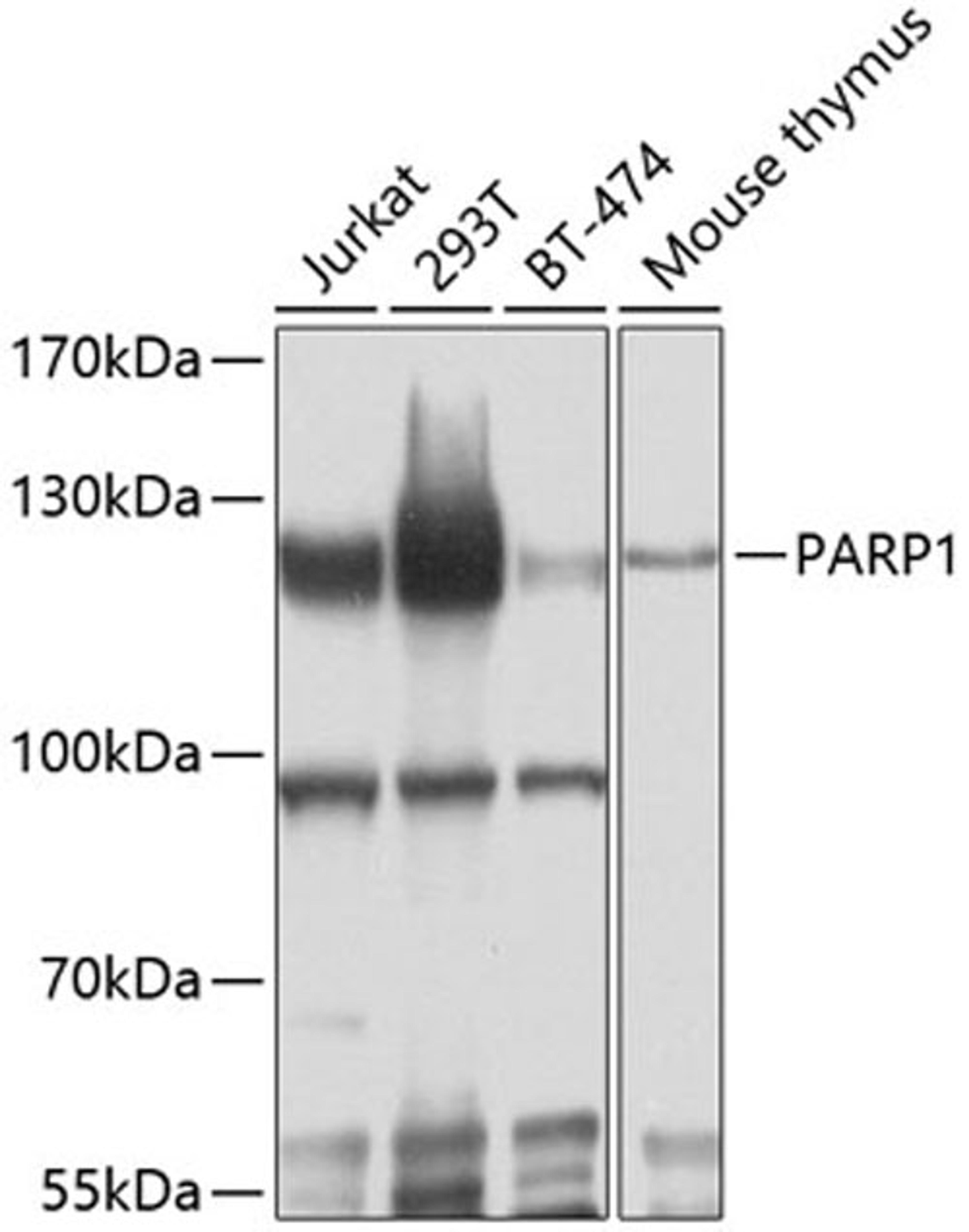 Western blot - PARP1 antibody (A11010)