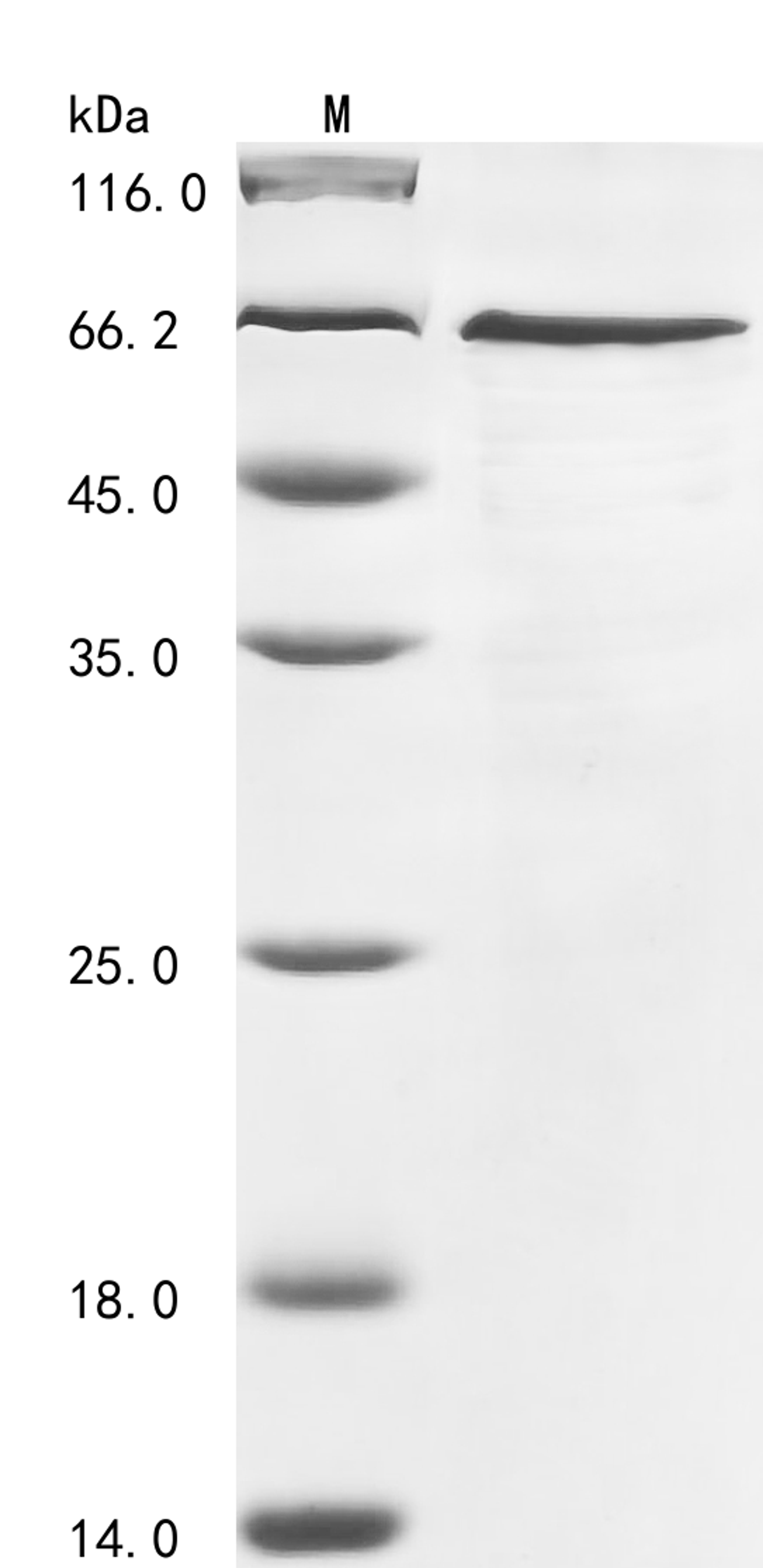 (Tris-Glycine gel) Discontinuous SDS-PAGE (reduced) with 5% enrichment gel and 15% separation gel.