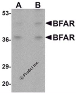 Western blot analysis of BFAR in human kidney tissue lysate with BFAR antibody at (A) 1 and (B) 2 &#956;g/mL.