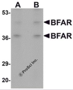 Western blot analysis of BFAR in human kidney tissue lysate with BFAR antibody at (A) 1 and (B) 2 μg/mL.
