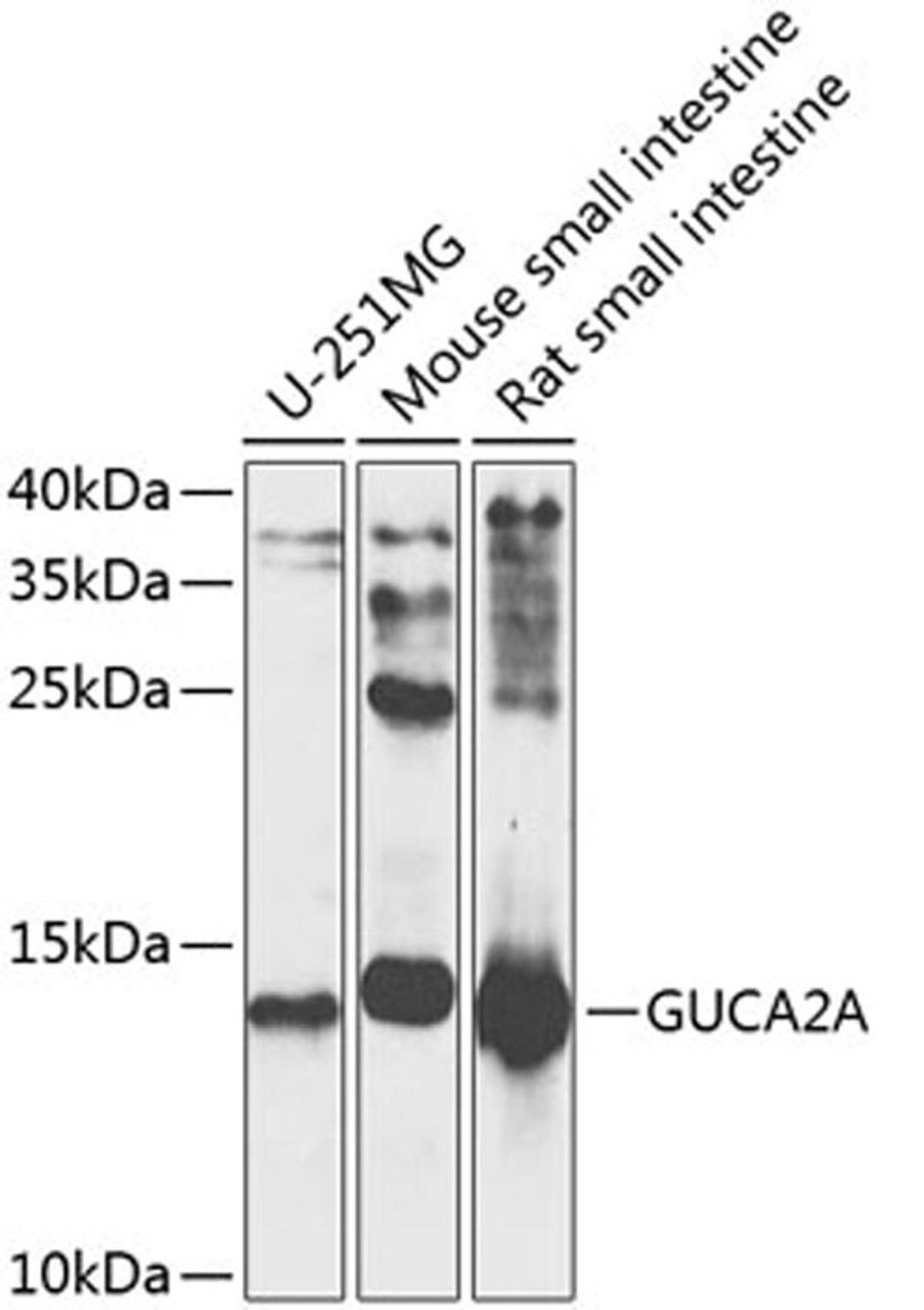 Western blot - GUCA2A antibody (A9820)