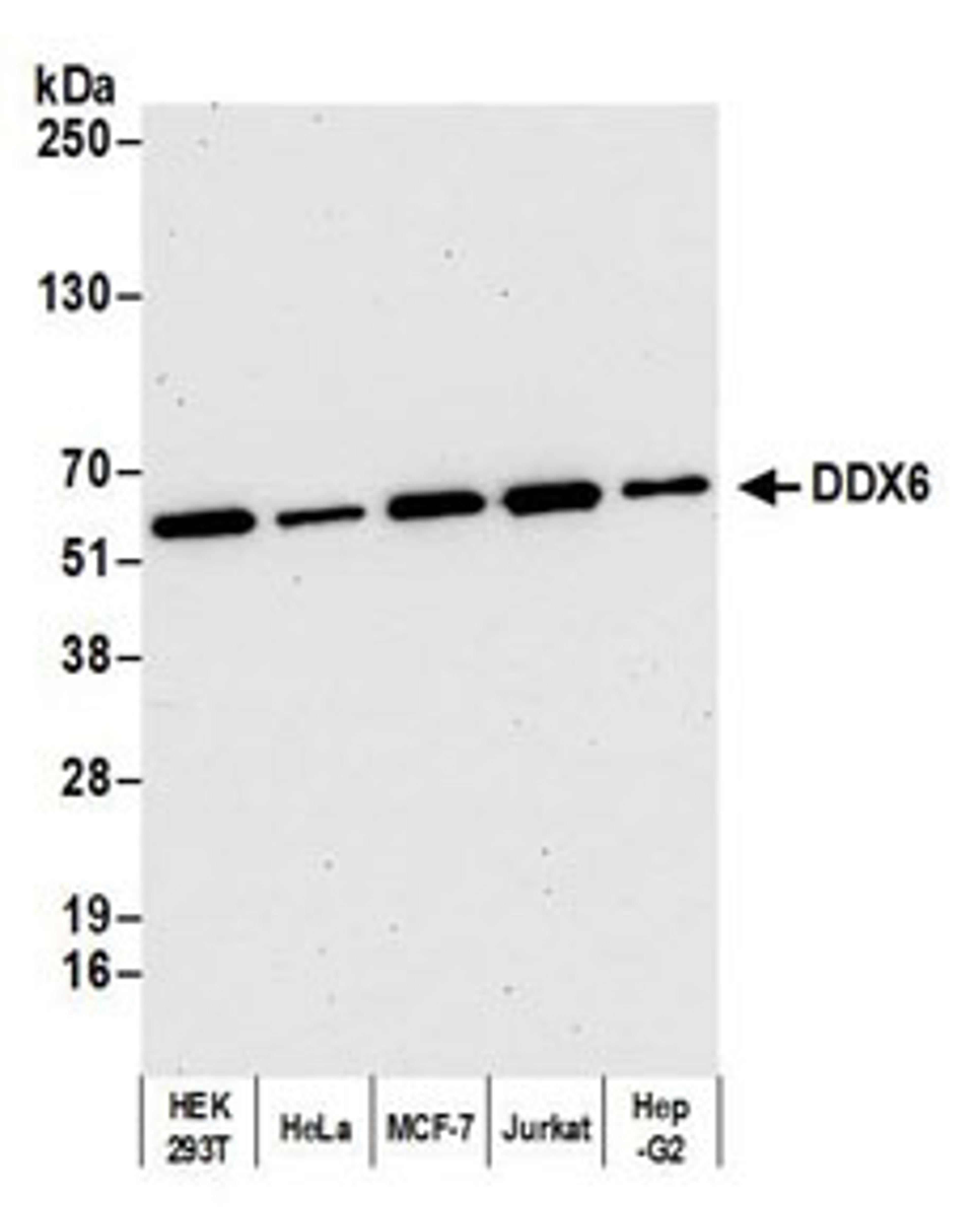 Detection of human DDX6 by western blot.