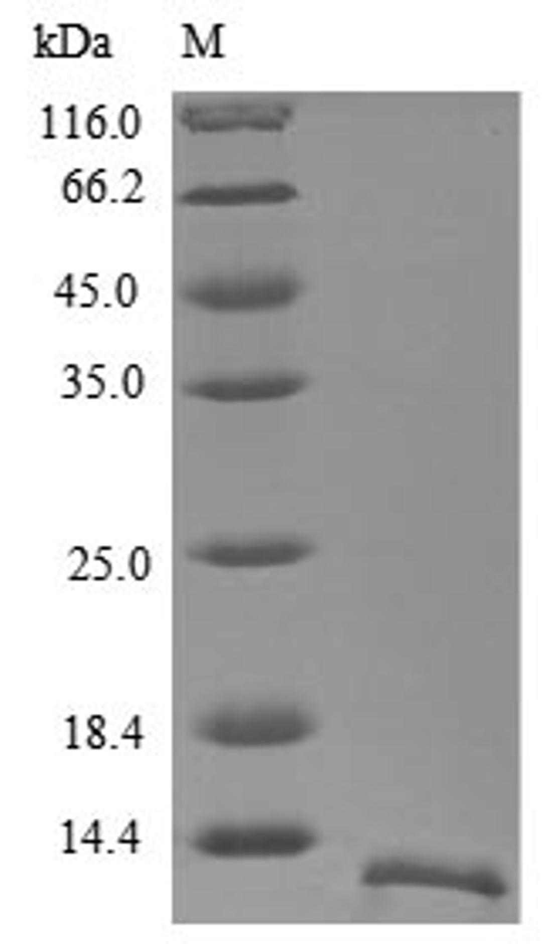(Tris-Glycine gel) Discontinuous SDS-PAGE (reduced) with 5% enrichment gel and 15% separation gel.