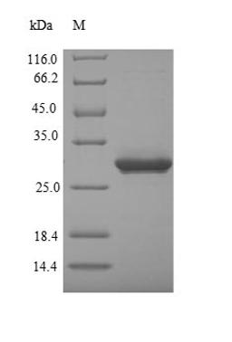 (Tris-Glycine gel) Discontinuous SDS-PAGE (reduced) with 5% enrichment gel and 15% separation gel.