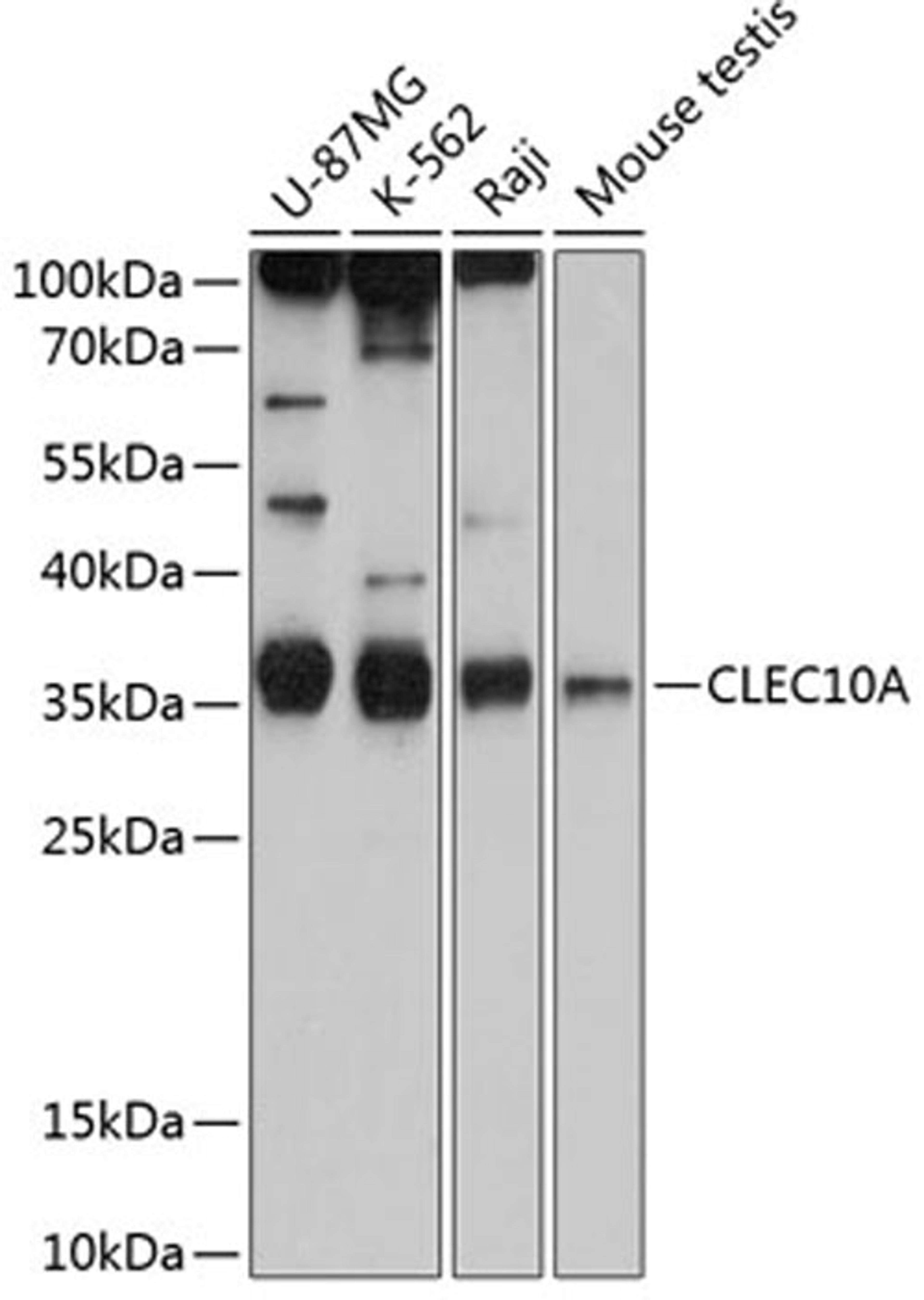 Western blot - CLEC10A antibody (A11859)