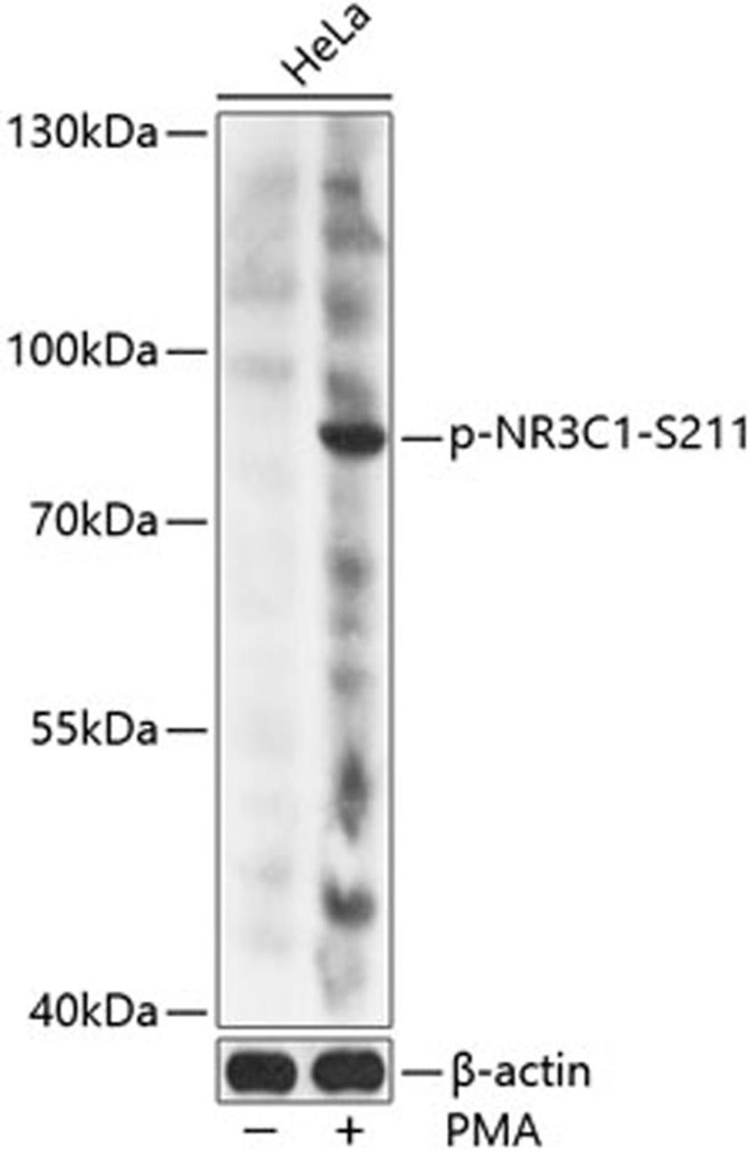 Western blot - Phospho-NR3C1-S211 antibody (AP0759)