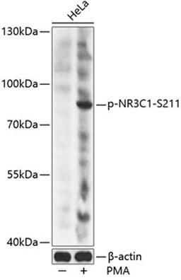 Western blot - Phospho-NR3C1-S211 antibody (AP0759)