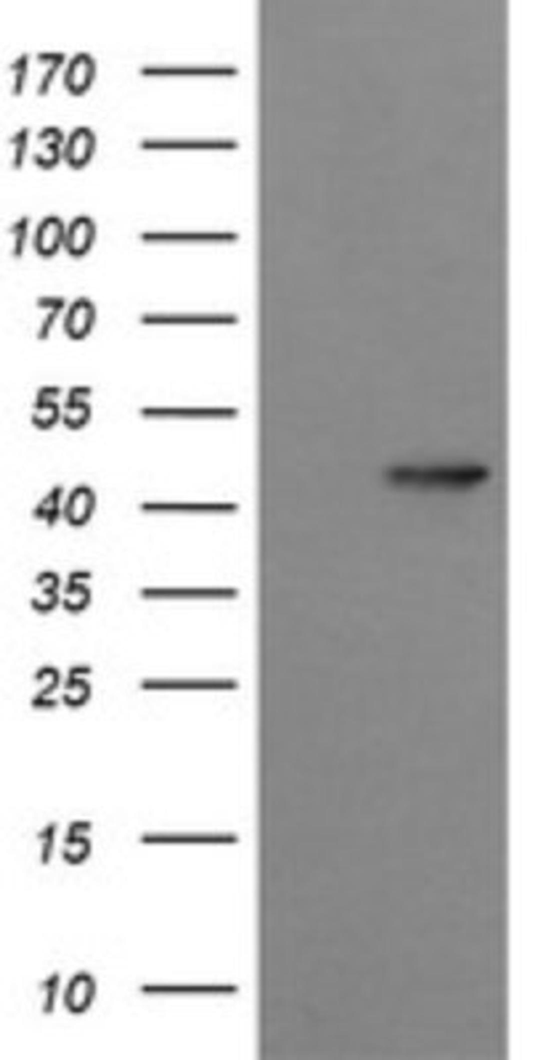 Western Blot: Synaptotagmin 4 Antibody (4H3) [NBP2-46045] - Analysis of HEK293T cells were transfected with the pCMV6-ENTRY control (Left lane) or pCMV6-ENTRY Synaptotagmin 4.