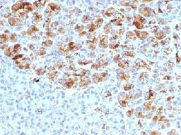 IHC testing of FFPE human pancreas with Alpha-1-Antichymotrypsin antibody (clone AACT/1452). Required HIER: steam sections in pH6, 10mM citrate buffer for 10-20 min.