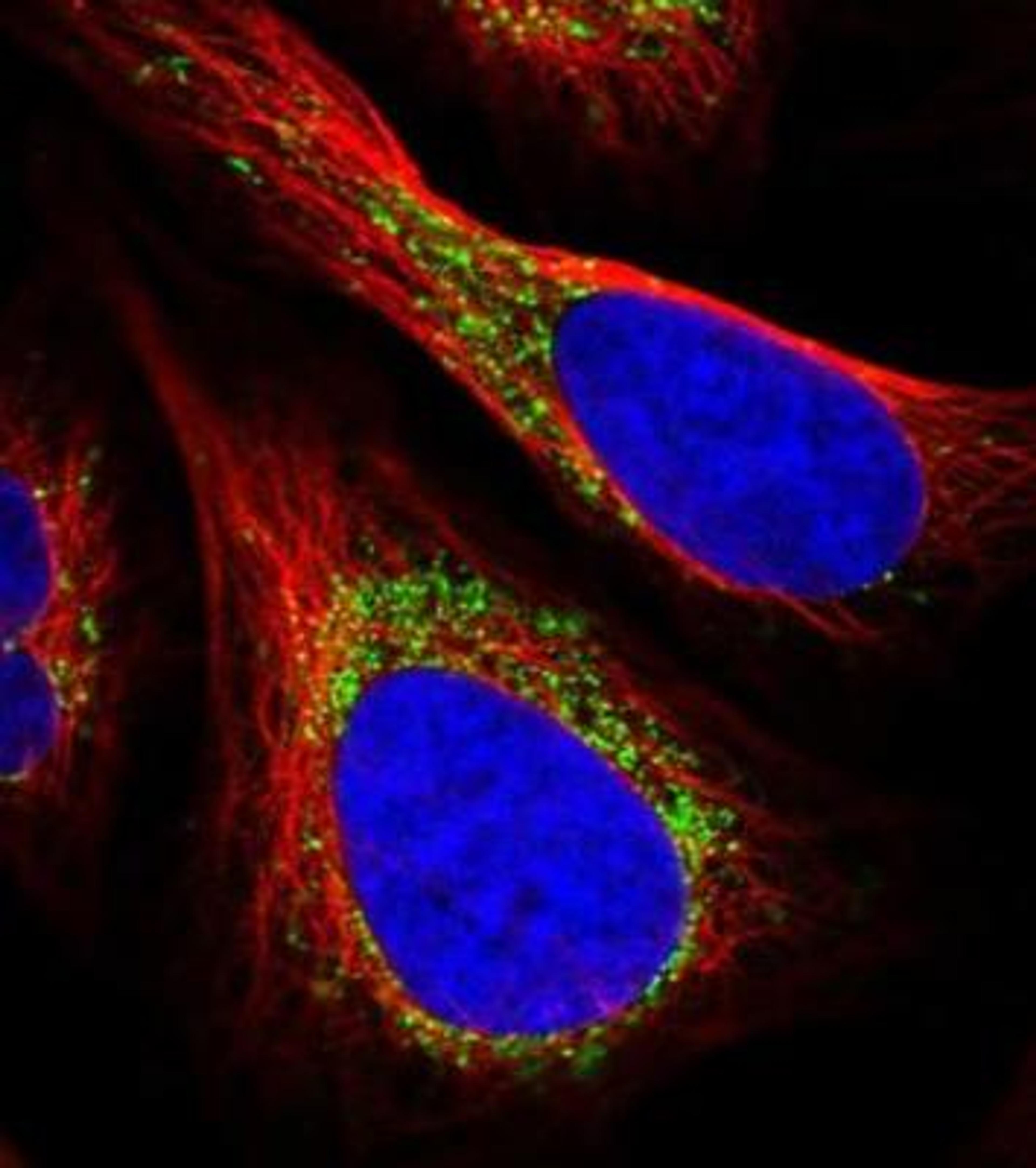 Immunocytochemistry/Immunofluorescence: VP26B Antibody [NBP1-92575] - Staining of human cell line U-2 OS shows positivity in vesicles.