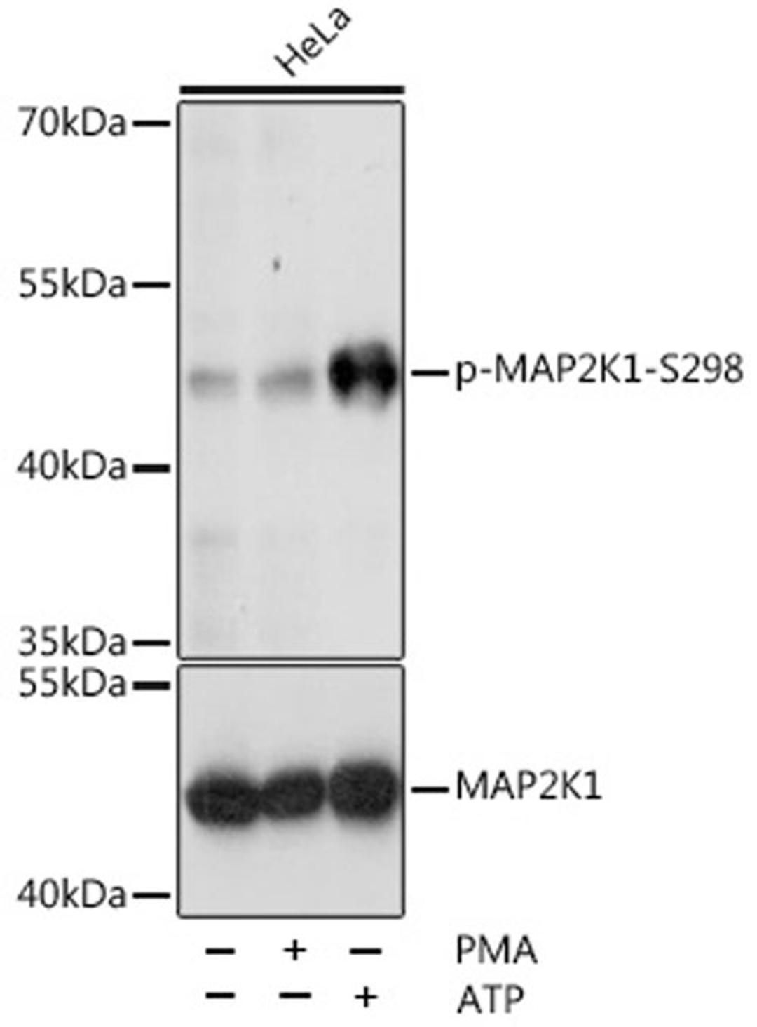 Western blot - Phospho-MAP2K1-S298 antibody (AP0063)