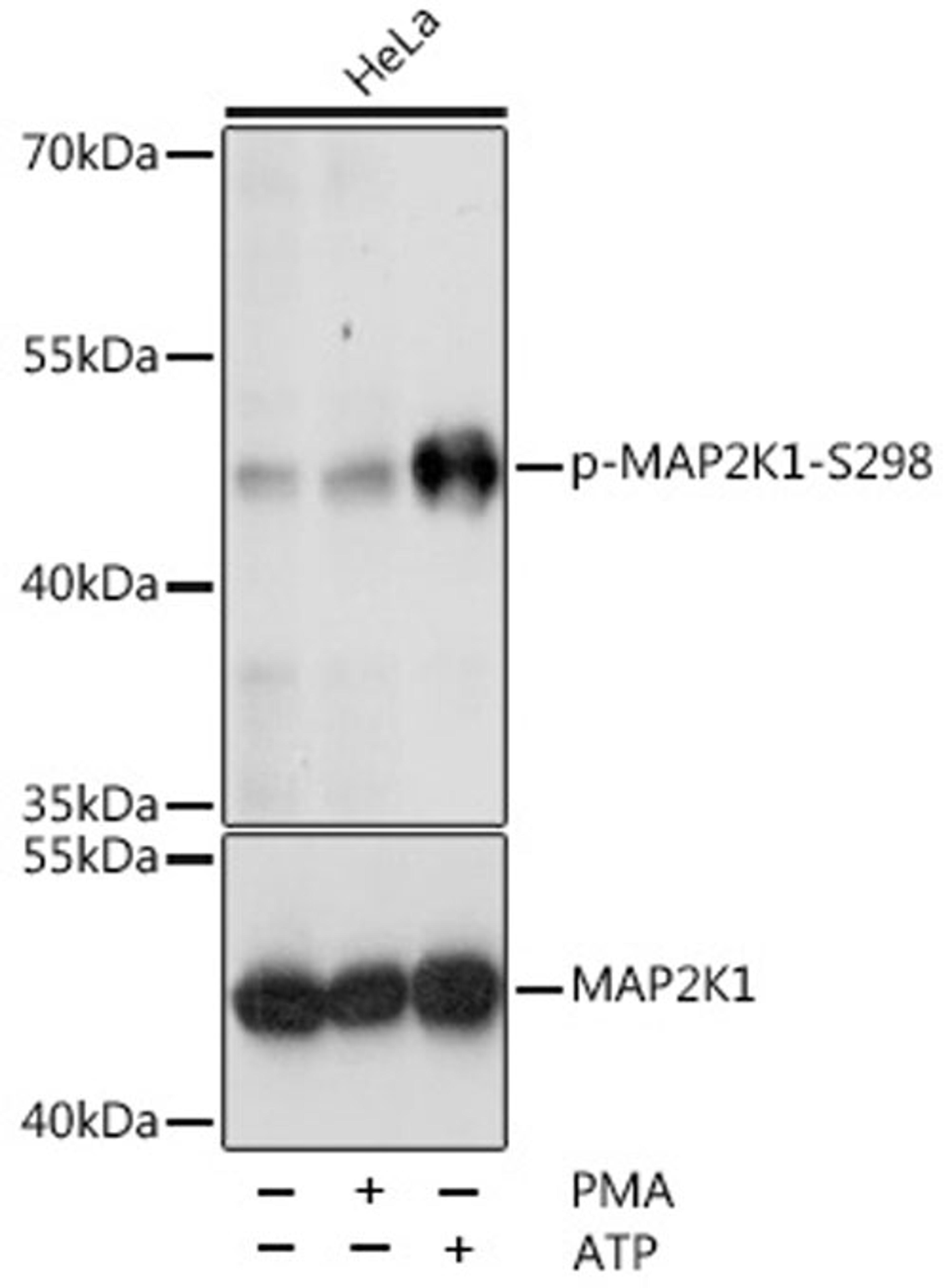 Western blot - Phospho-MAP2K1-S298 antibody (AP0063)