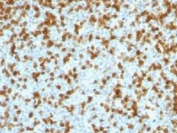 IHC testing of FFPE human tonsil with recombinant PD1 antibody (clone PDCD1/1410R). Required HIER: steam sections in 10mM Tris with 1mM EDTA, pH 9.0, for 10-20 min.