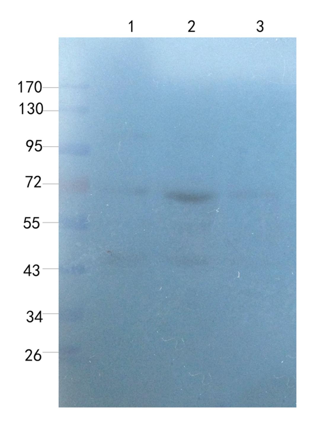 Western blot analysis of rat thyroid (lane 1), rat uterus (lane 2), rat ovary (lane 3) using Myeloperoxidase antibody (1 ug/ml)