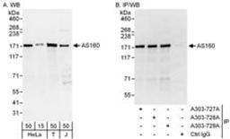 Detection of human AS160 by western blot and immunoprecipitation.