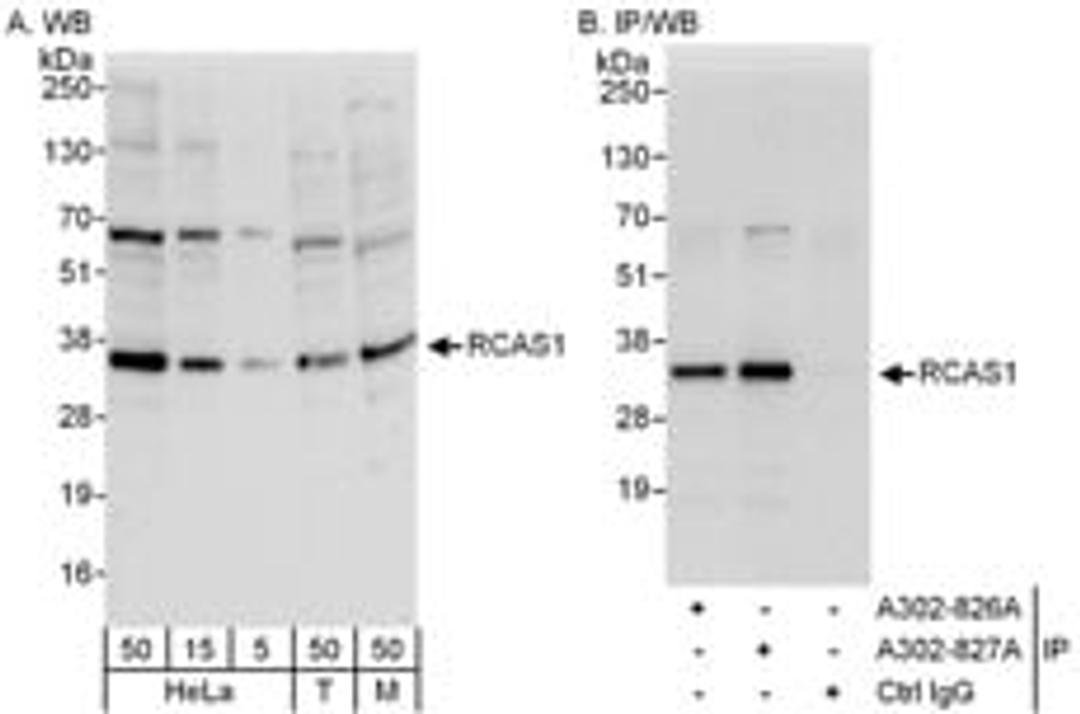 Detection of human and mouse RCAS1 by western blot (h&m) and immunoprecipitation (h).