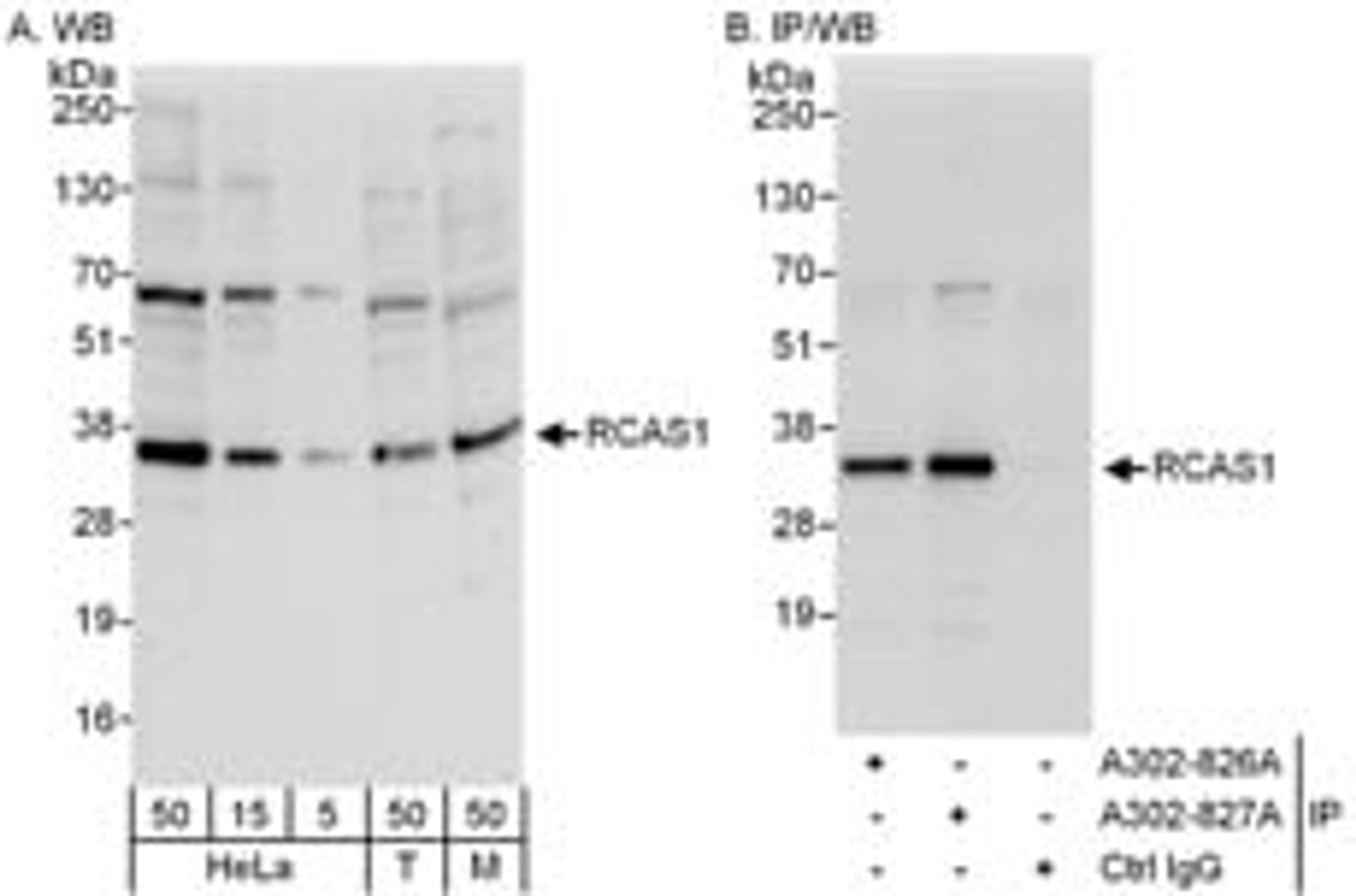 Detection of human and mouse RCAS1 by western blot (h&m) and immunoprecipitation (h).