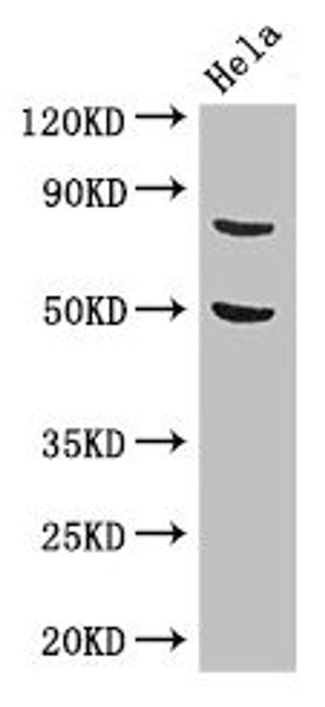 Western Blot. Positive WB detected in: Hela whole cell lysate. All lanes: KBTBD6 antibody at 3.4µg/ml. Secondary. Goat polyclonal to rabbit IgG at 1/50000 dilution. Predicted band size: 77 kDa. Observed band size: 77 kDa
